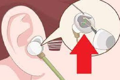 Por Qué Deja De Sonar Un Audífono – Causas Y Soluciones