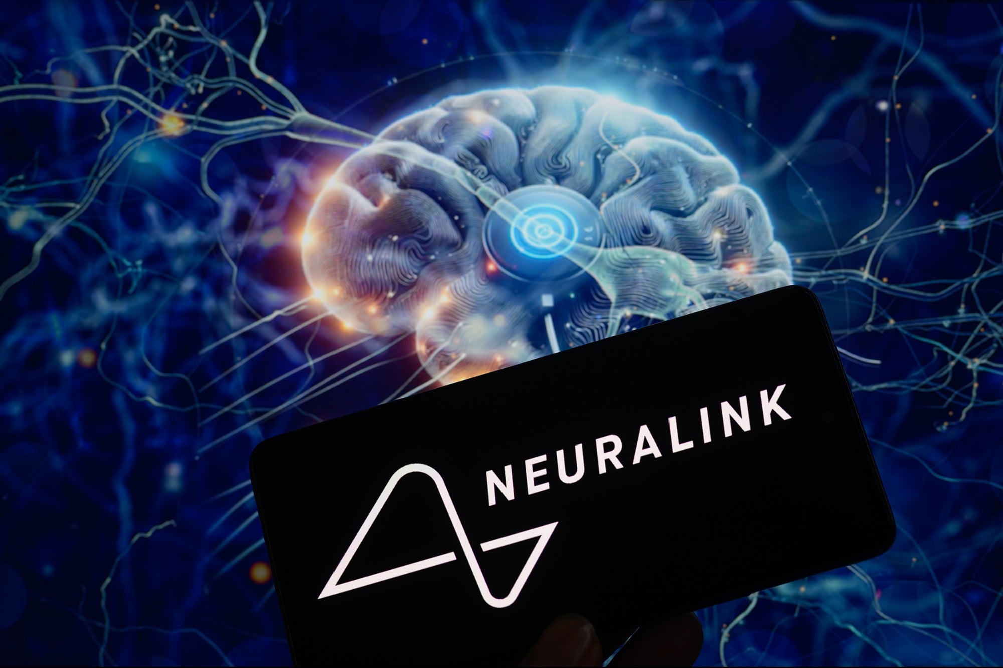 Neuralink y calidad de vida
