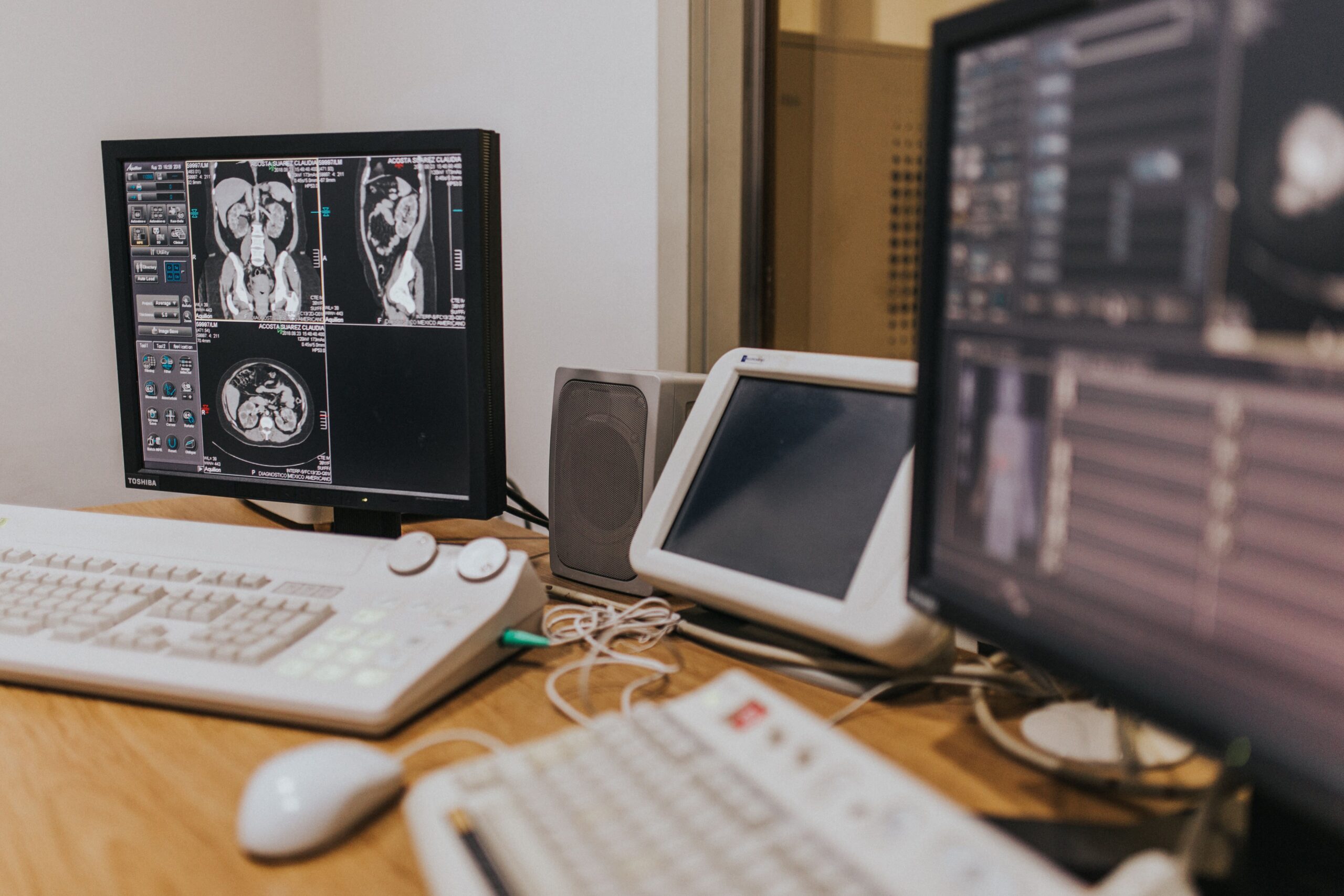 Estación de trabajo de radiología con múltiples pantallas mostrando cortes anatómicos de tomografía computarizada abdominal
