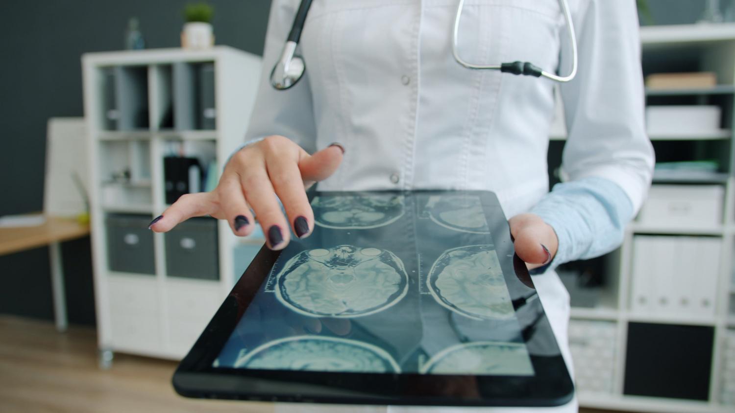 Médico analizando escaneos cerebrales en una tablet, ilustrando el uso de IA para la detección temprana de anomalías médicas.